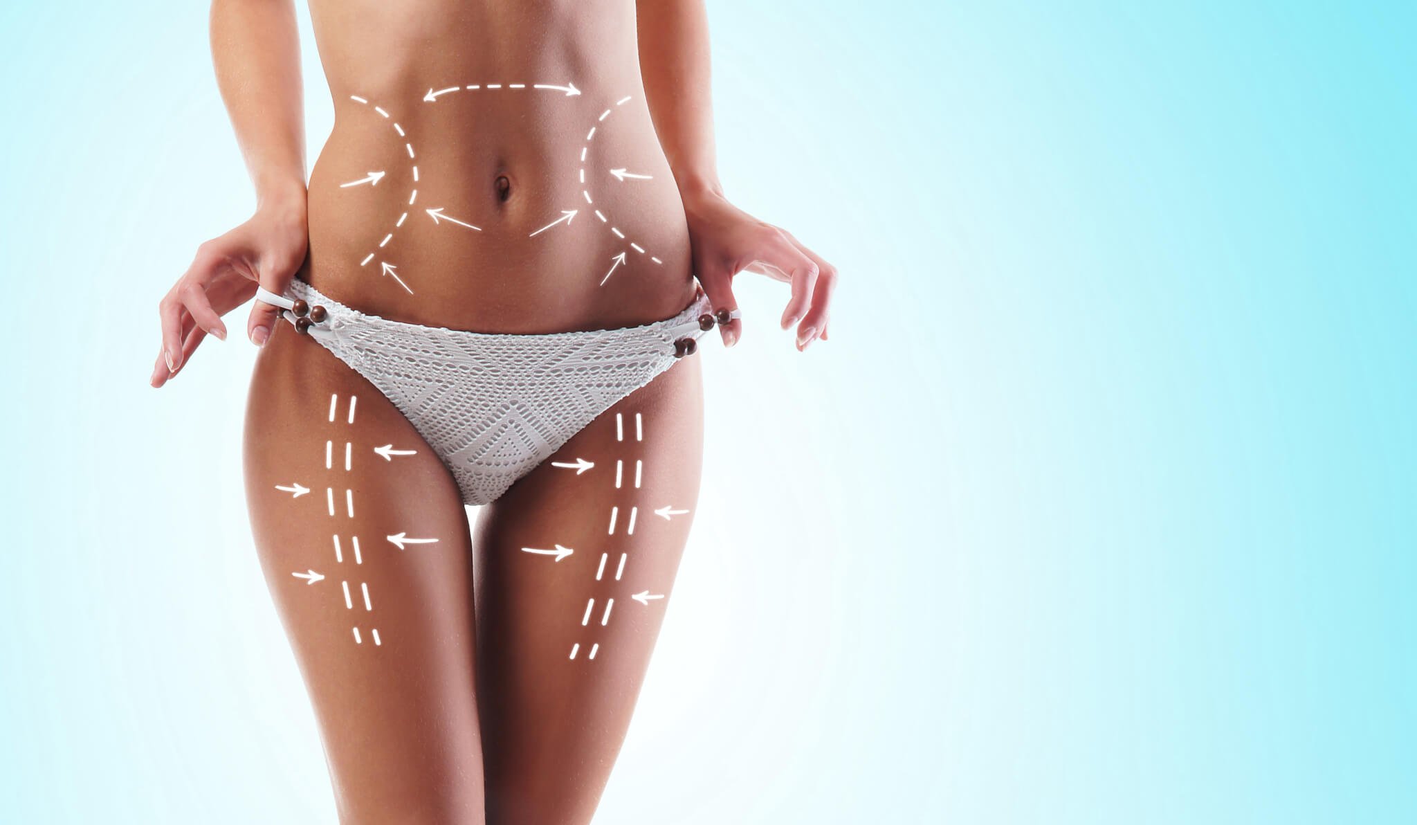 Liposuction or Abdominoplasty, What's Better